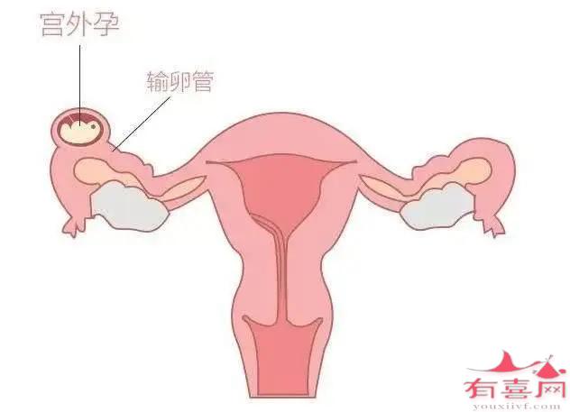五联疫苗是打收费的还是免费的（来看看来自医生们的建议）